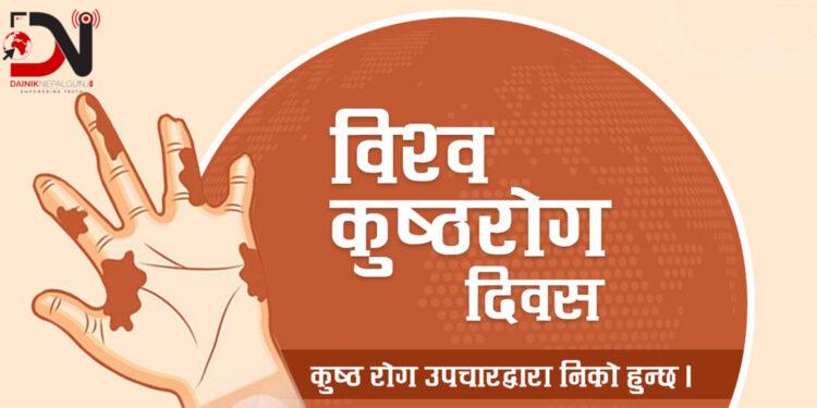 आज कुष्ठरोग दिवस