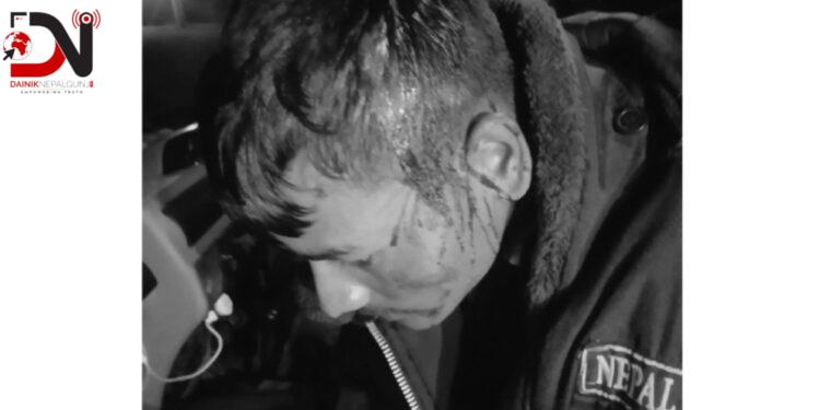 स्थानीयको आक्रमणमा दुई प्रहरी घाइते