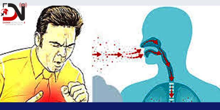 पैँतालिस प्रतिशत क्षयरोगका बिरामी उपचारभन्दा बाहिर