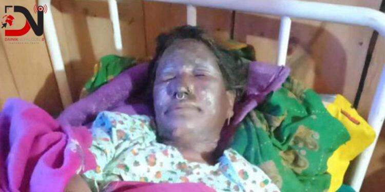 डढेलो निभाउने क्रममा महिला घाइते