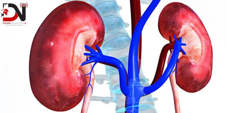 मिर्गौलाको सुरक्षातर्फ बढ्दो जनचासो