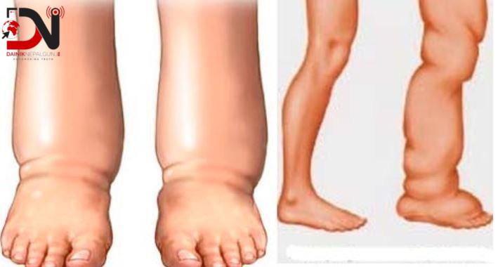 देशमा आजः ८ बजे ८ खबर