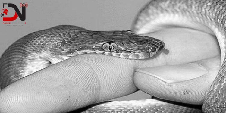 बारबर्दिया नगरअस्पतालमा निःशुल्क सर्पदंश उपचार सेवा सुरू