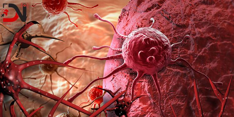 आज क्यान्सर निःशुल्क पहिचान गरिंदै