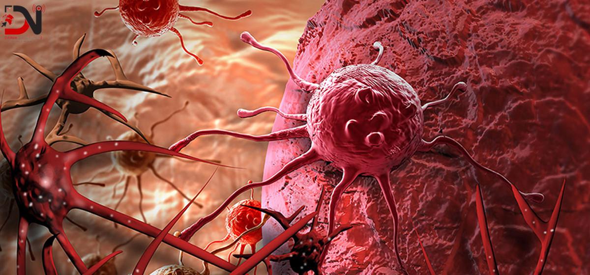 आज क्यान्सर निःशुल्क पहिचान गरिंदै