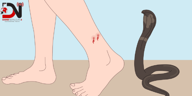 समयमै अस्पताल नपुग्दा ज्यान गुमाउँदै सर्पदंशका बिरामी