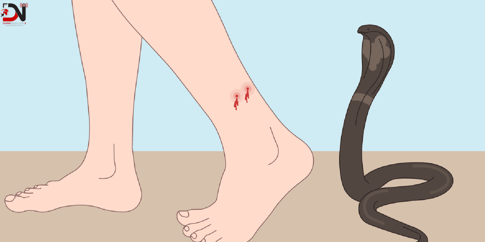 समयमै अस्पताल नपुग्दा ज्यान गुमाउँदै सर्पदंशका बिरामी