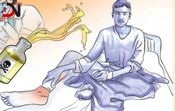 नेपालगन्जमा ‘वर्न केयर सेन्टर’ पहल