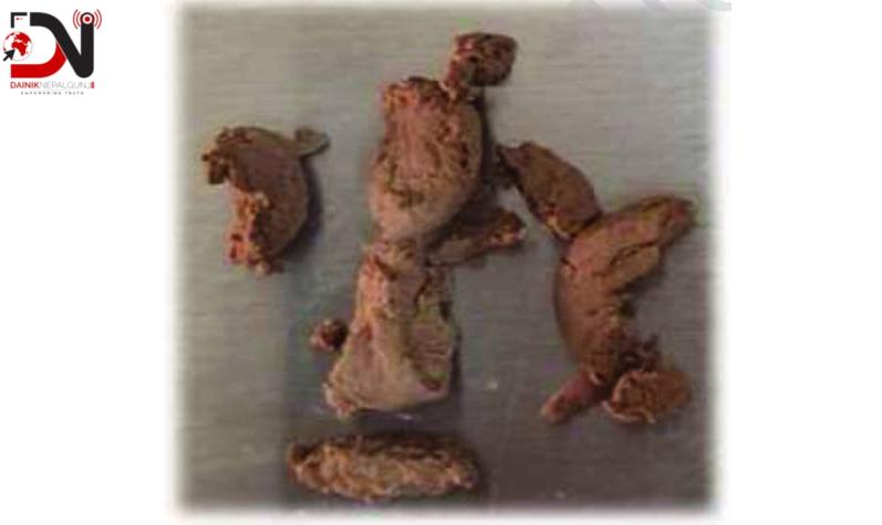 नेपालगन्जमा ब्राउन सुगर र ट्रामाडोलसहित दुई पक्राउ