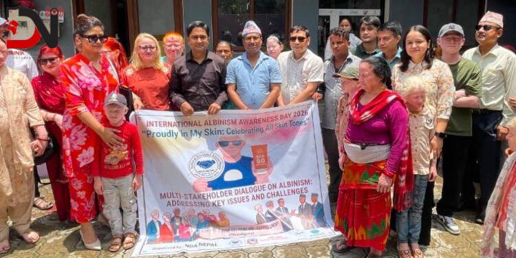 नेपालगन्जमा एल्बिनिज्म सचेतना दिवस