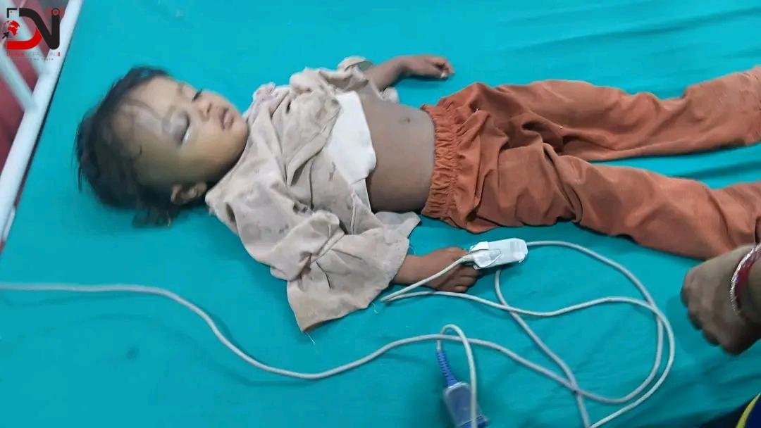 सुर्खेतमा हिंसात्मक घटनाबाट घाइते २ वर्षीया बालिकाको शल्यक्रिया